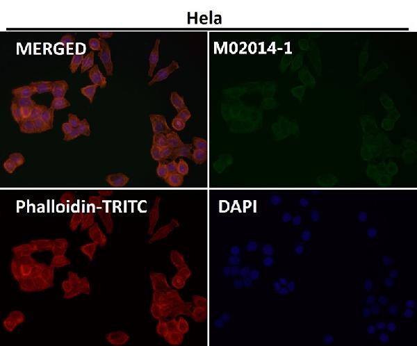 WB - Anti-Actin ACTA1 Rabbit Monoclonal Antibody ABO13566
